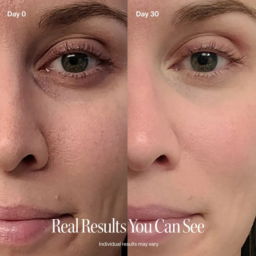 Before and after comparison of a woman's eye area with text 'Real Results You Can See'.  before-after || Charcoal